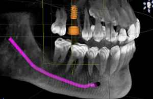 3-D X-rays